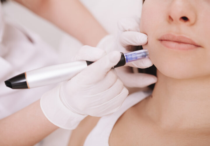 Cropped close up of unrecognizable woman getting mesotherapy procedure at beauty clinic